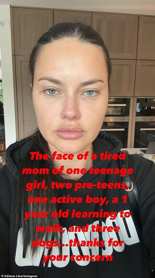 Adriana Lima’s Transformed Appearance Fuels Speculation About Dissolved Fillers and Rumors