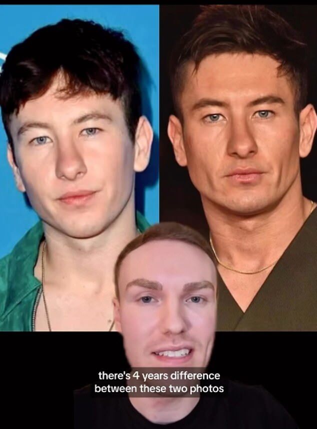 Barry Keoghan's Chiseled Transformation: Experts Discuss Possible Cosmetic Procedures Behind Change