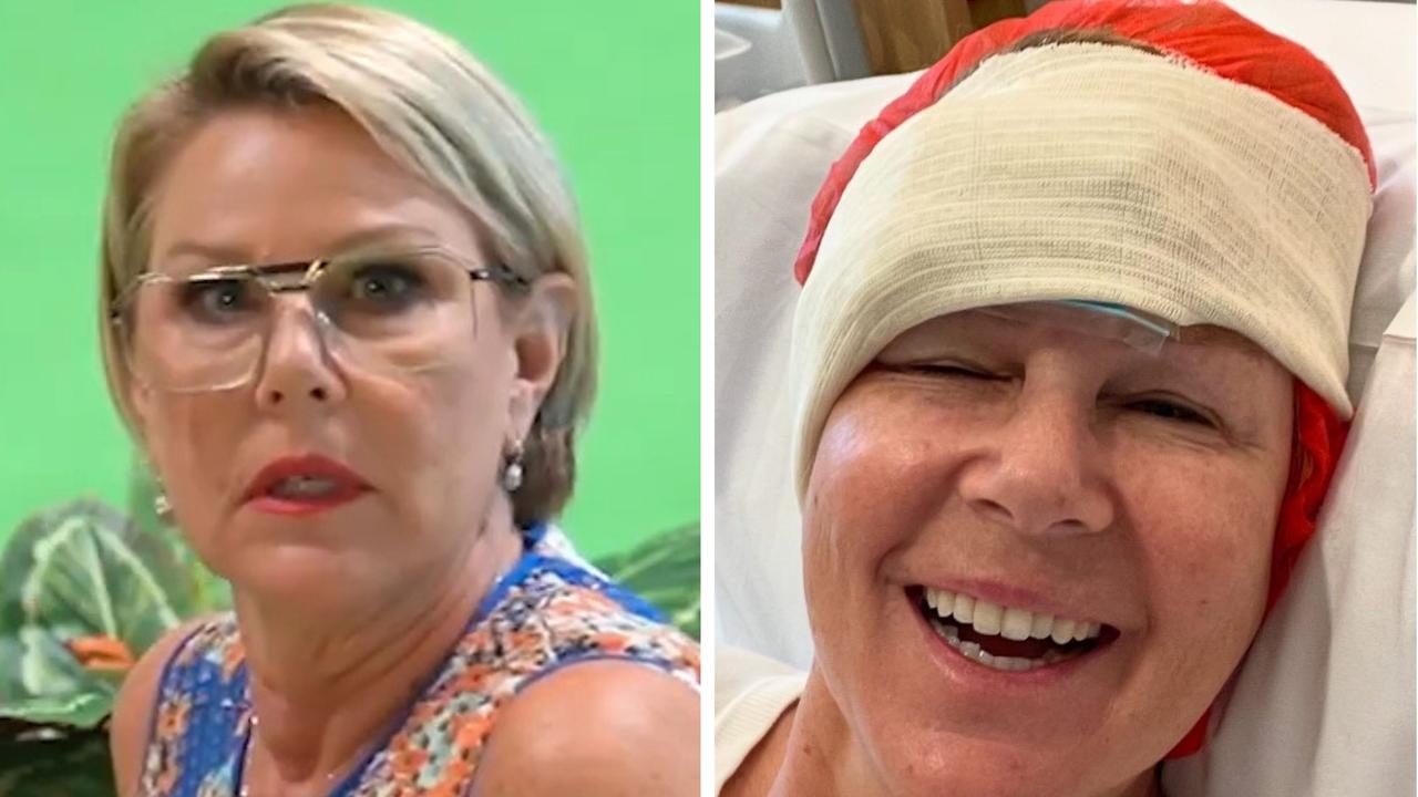 Julia Morris Highlights Skin Cancer Health Scare in Hospital Bed Selfie