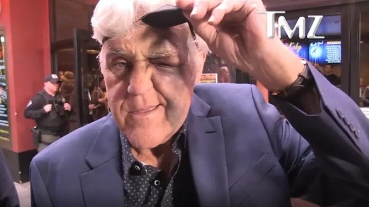 Jay Leno Injured in Fall from Steep Hill, Performs Hours Later Despite Eye Injury