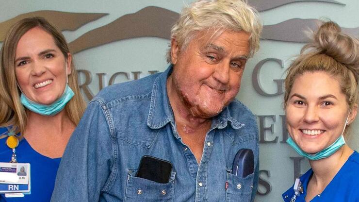 Jay Leno Injured in Fall from Steep Hill, Performs Hours Later Despite Eye Injury